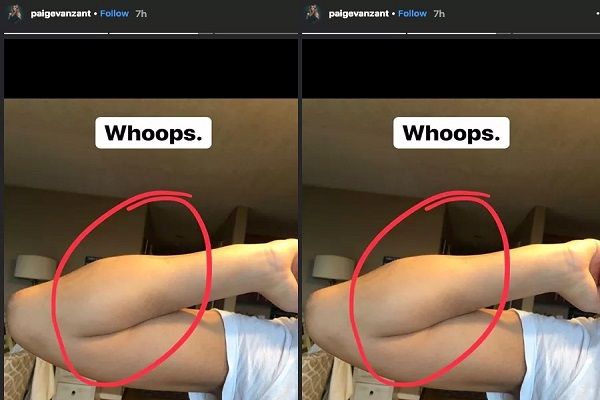 Antes escalada para o UFC 236, Paige VanZant revela nova fratura no braço