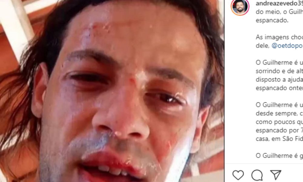 Homofobia! Narrador do SporTV relata ataque e espancamento de seu irmão