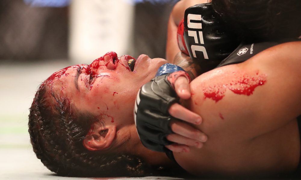 Dana revela que Peña vai precisar fazer cirurgia plástica após revés para Amanda