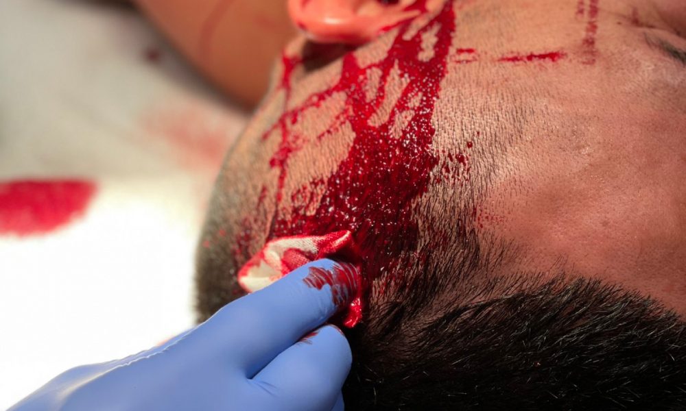 Susto! Lutador sofre corte em artéria no UFC Vegas 66