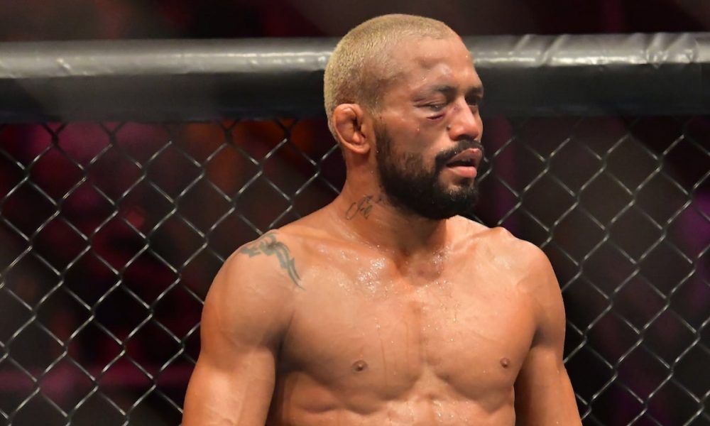 Com o olho inchado e cortado, Deiveson Figueiredo reage à derrota para Brandon Moreno no UFC Rio