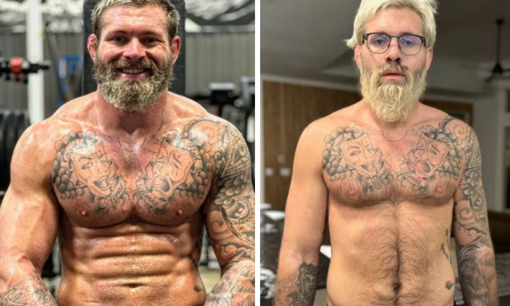 Gordon Ryan antes e depois do problema de saúde que o fez passar por cirurgia e pausar a carreira.