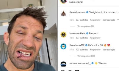 Luke Rockhold tem dentes quebrados e lábio cortado em luta contra Mike Perry no boxe sem luvas