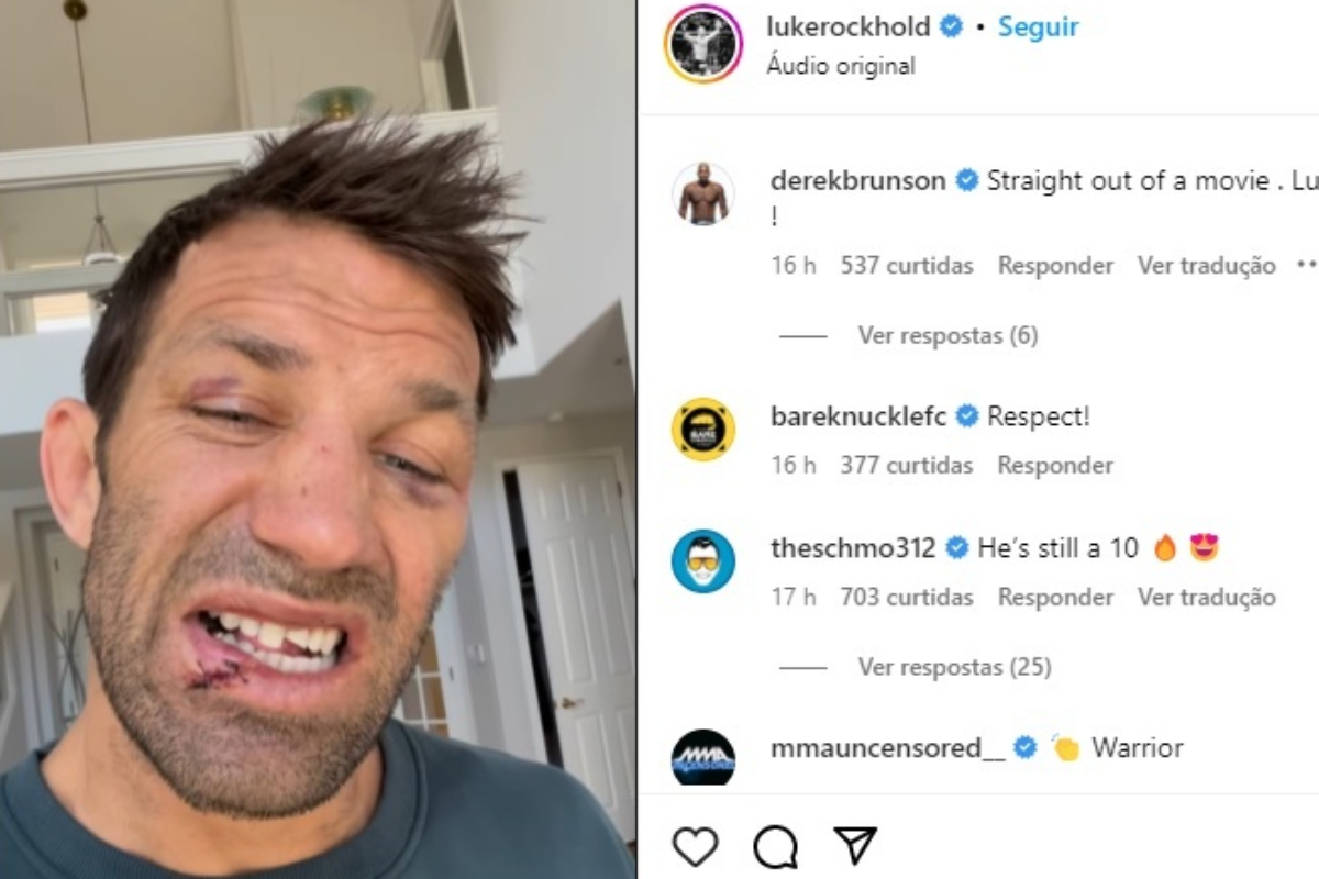 Luke Rockhold tem dentes quebrados e lábio cortado em luta contra Mike Perry no boxe sem luvas