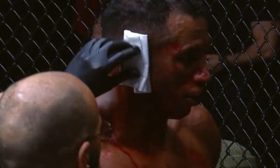 O brasileiro Vinicius Cruz quase teve a orelha decepada em luta no ACA.