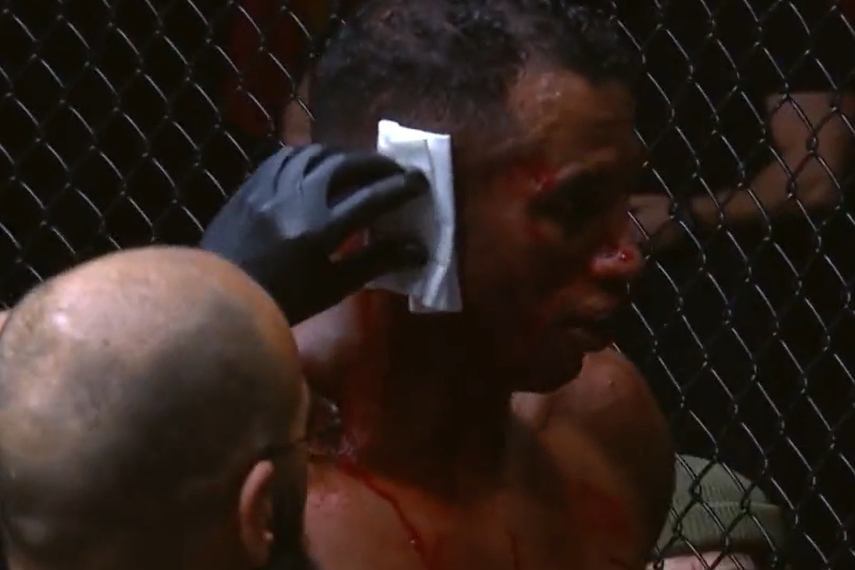 O brasileiro Vinicius Cruz quase teve a orelha decepada em luta no ACA.