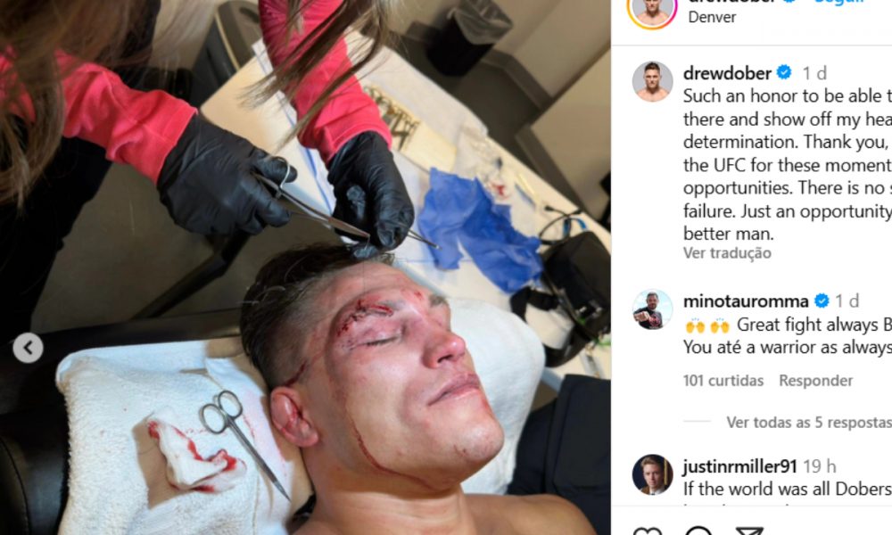 Drew Dober recebe pontos no supercílio após derrota para Jean Silva no UFC Denver.