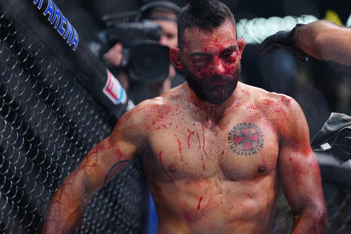 Benoit Saint Denis com o rosto desfigurado e ensanguentado após derrota para Renato Moicano no UFC Paris.