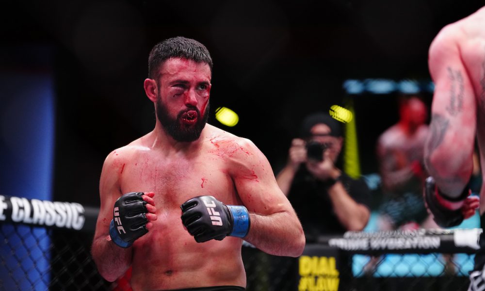 Imagem forte! Lutador exibe lábio rasgado após derrota no UFC Vegas 105; veja