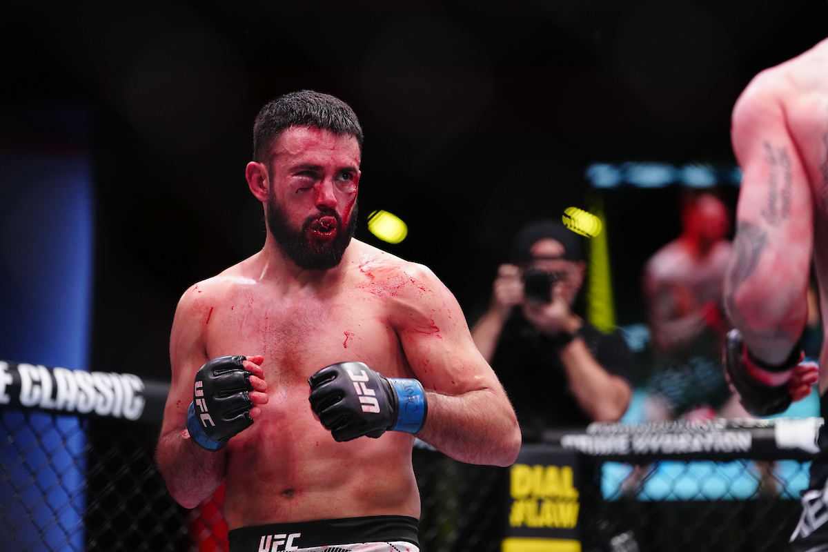 Daniel Frunza com o rosto desfigurado durante luta no UFC Vegas 105