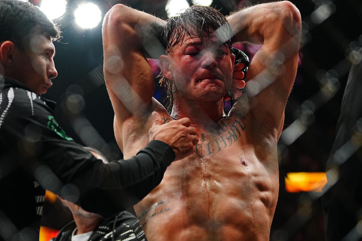 Diego Lopes lamenta derrota no UFC 314