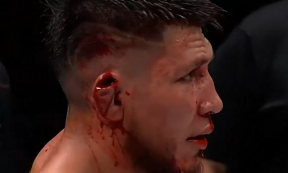 Ex-Contender Series sofre lesão grotesca na orelha em evento nos EUA; veja