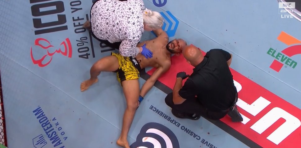 Veja o momento da lesão de Deiveson Figueiredo no UFC Des Moines