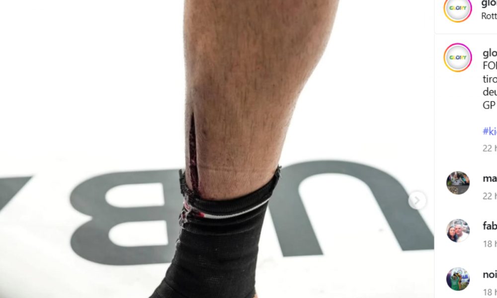 Imagem forte! Lutador sofre corte feio na canela em luta de kickboxing; veja