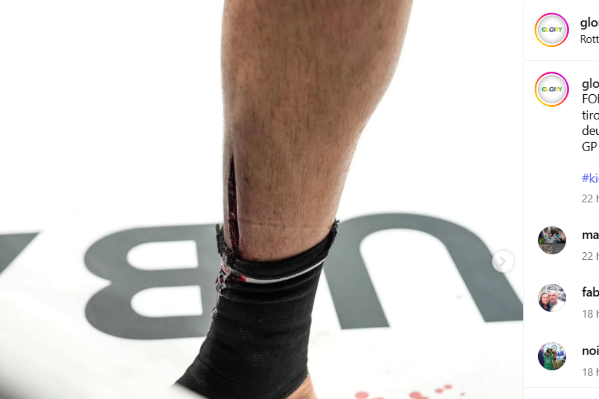 Corte profundo na canela de Jamal Ben Saddik no Glory 100