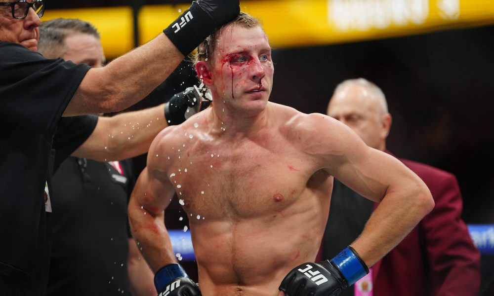 Paddy Pimblett quebra o silêncio após derrota para Gaethje no UFC 324: “O melhor venceu”