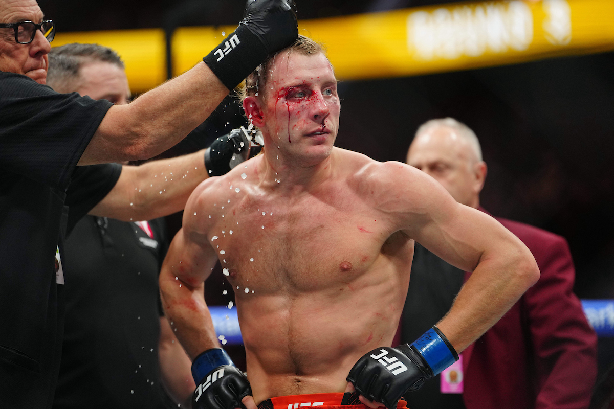 Paddy Pimblett ensanguentado no intervalo do duelo no UFC 324