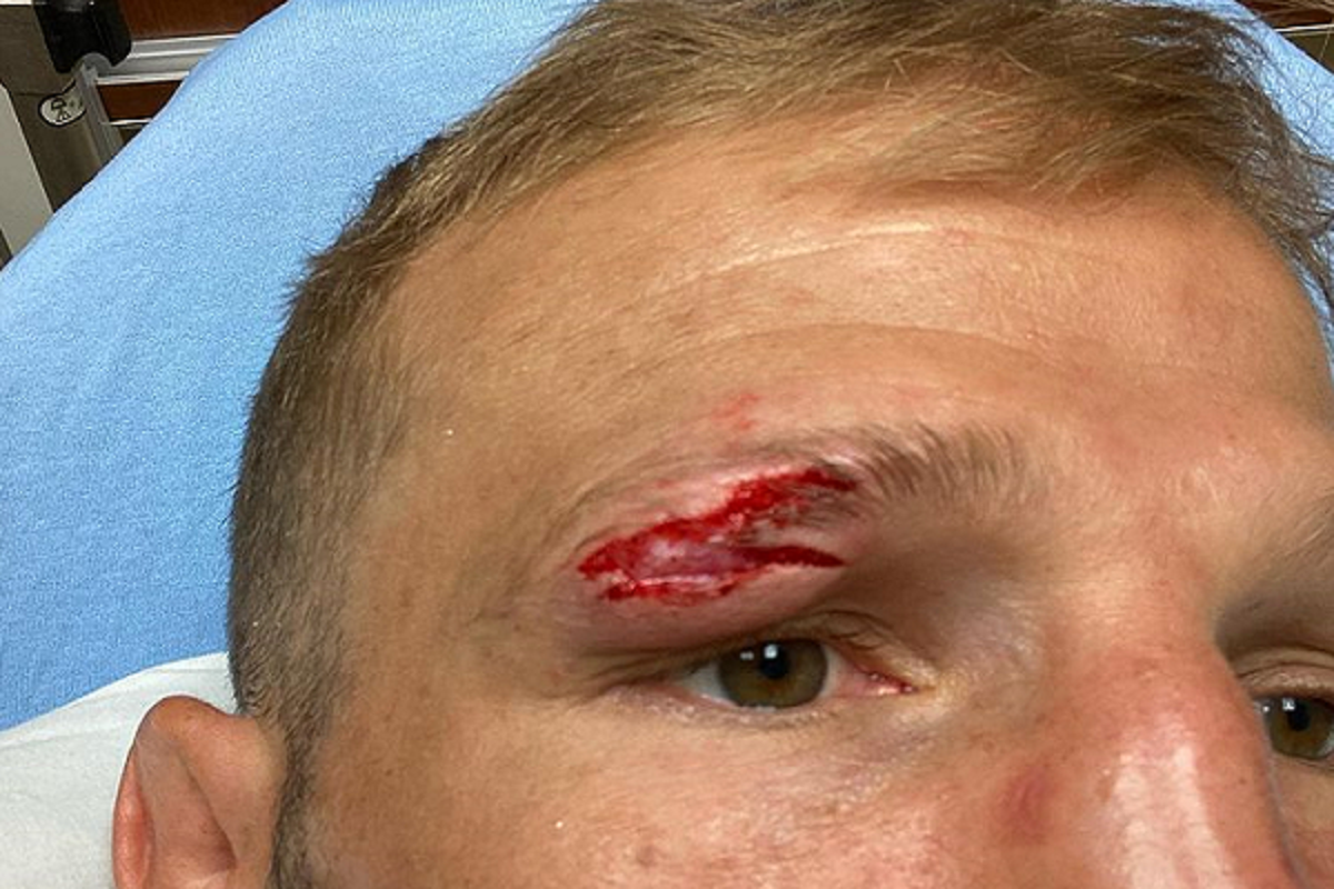 TJ Dillashaw