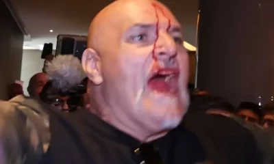 john-fury-cabecada-sangue-boxe