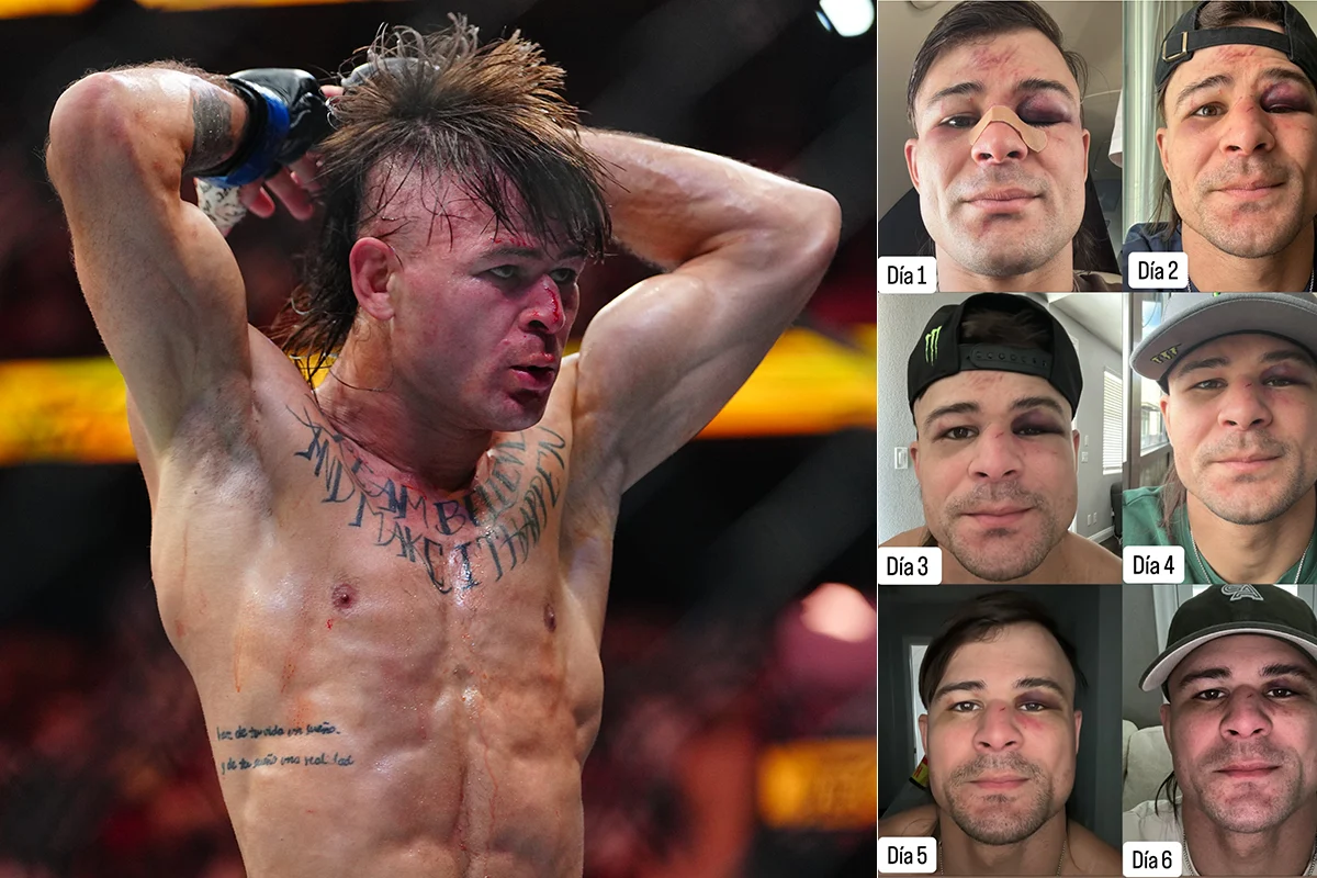 Diego-Lopes-Volkanovski