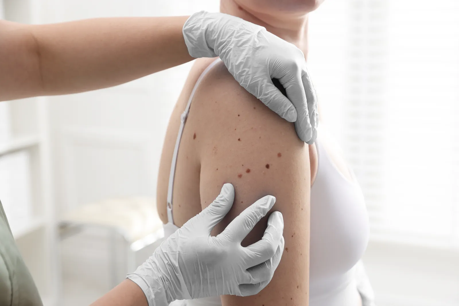 Diagnose von Kontaktekzemen