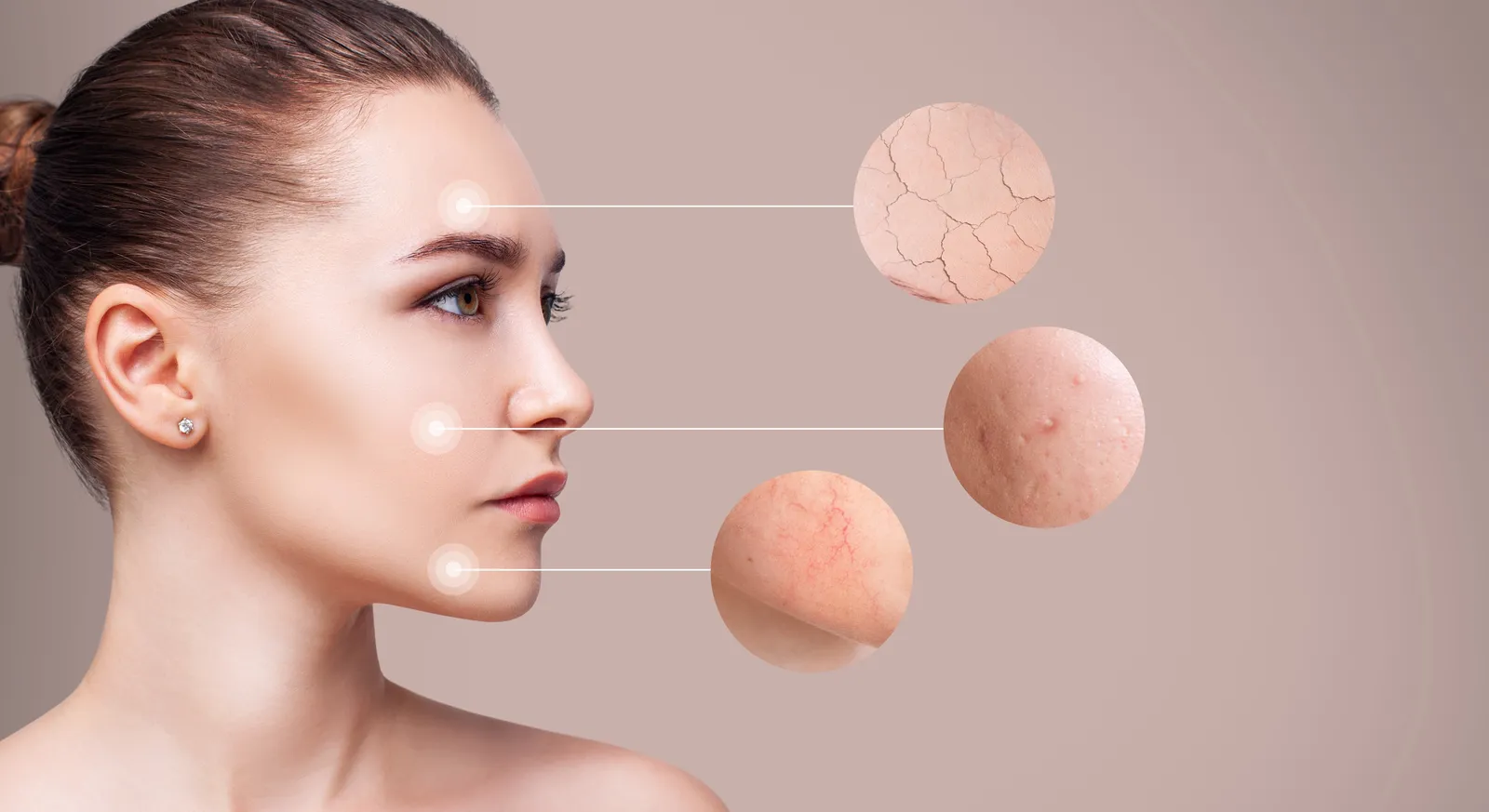 Sonneneinstrahlung auf die Haut