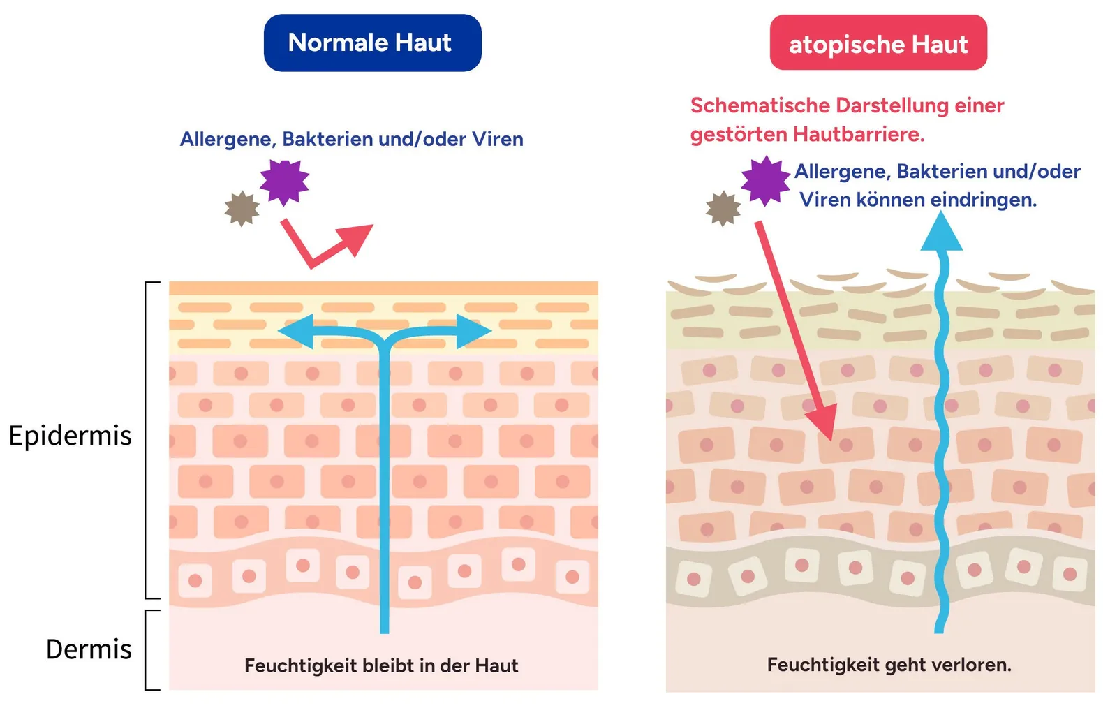 Schema: Normale vs Atopische Haut