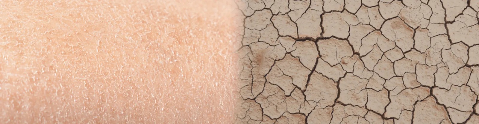 Sanfte Pflege für trockene, gespannte und juckende Haut 