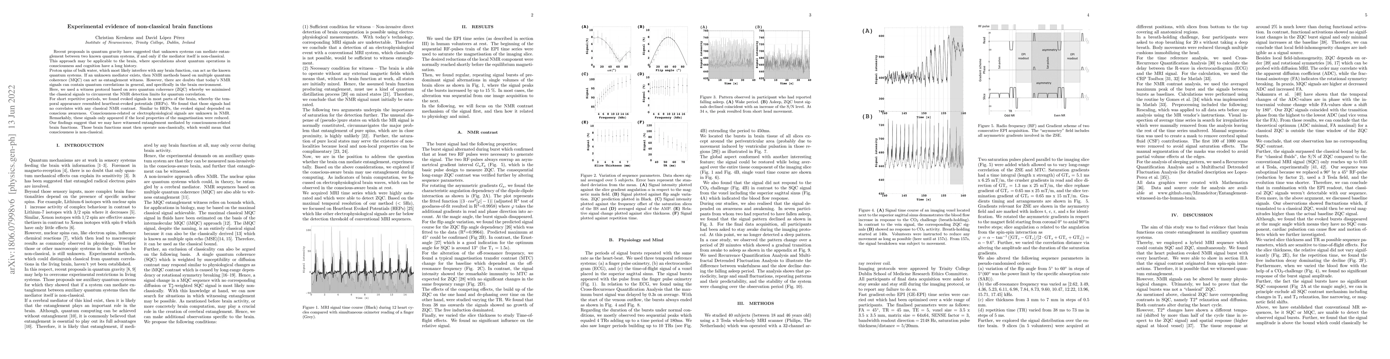 Thumbnail for Experimental evidence of non-classical brain functions
