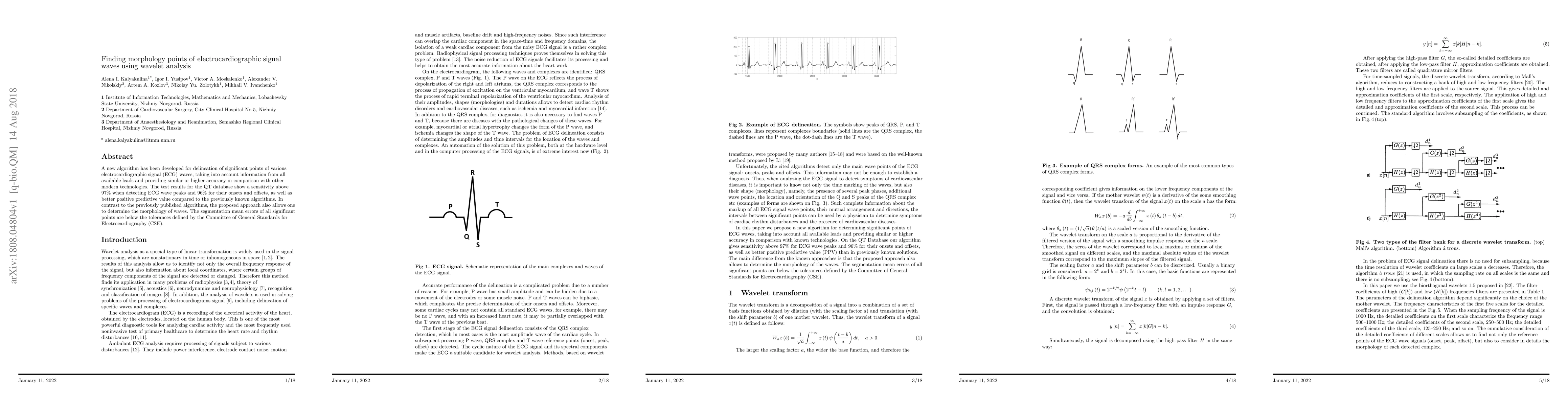 Thumbnail for Finding morphology points of electrocardiographic signal waves using
  wavelet analysis