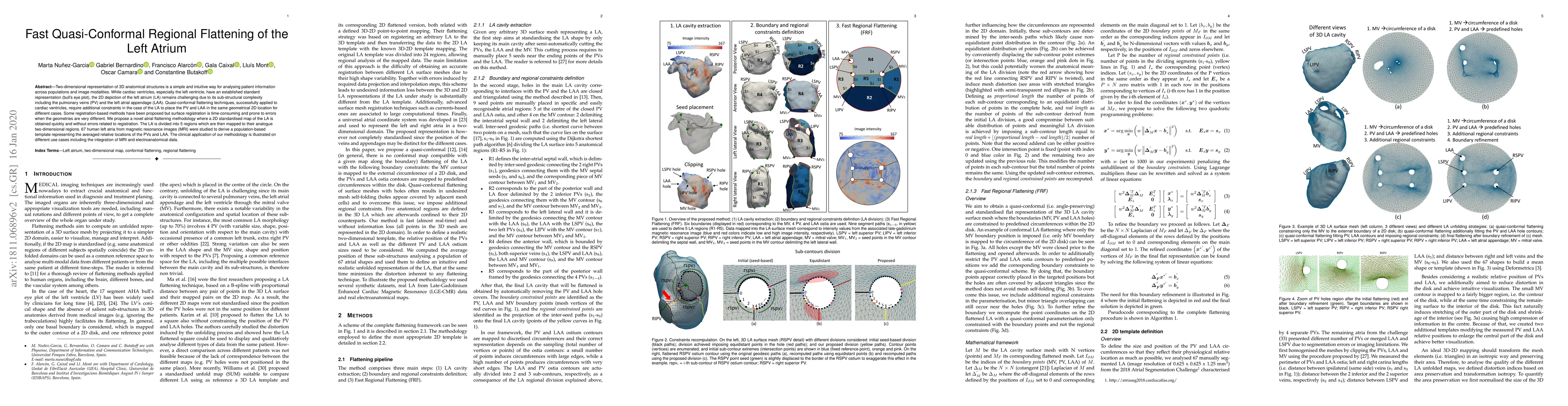 Thumbnail for Fast quasi-conformal regional flattening of the left atrium