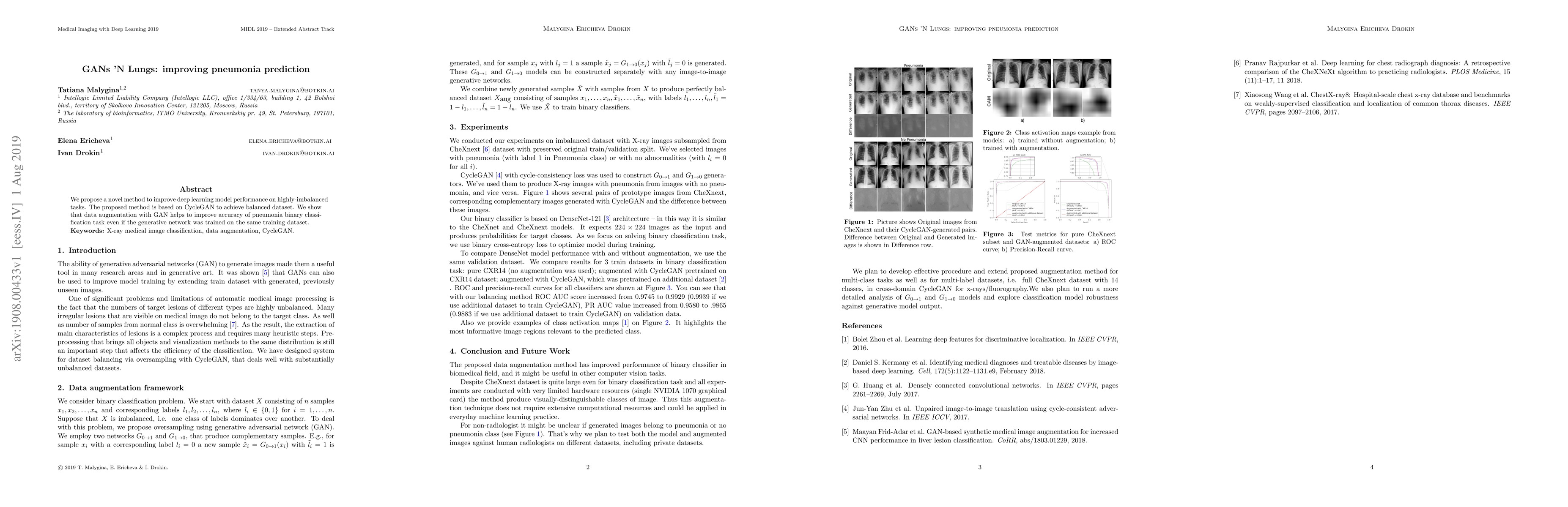 Thumbnail for GANs 'N Lungs: improving pneumonia prediction