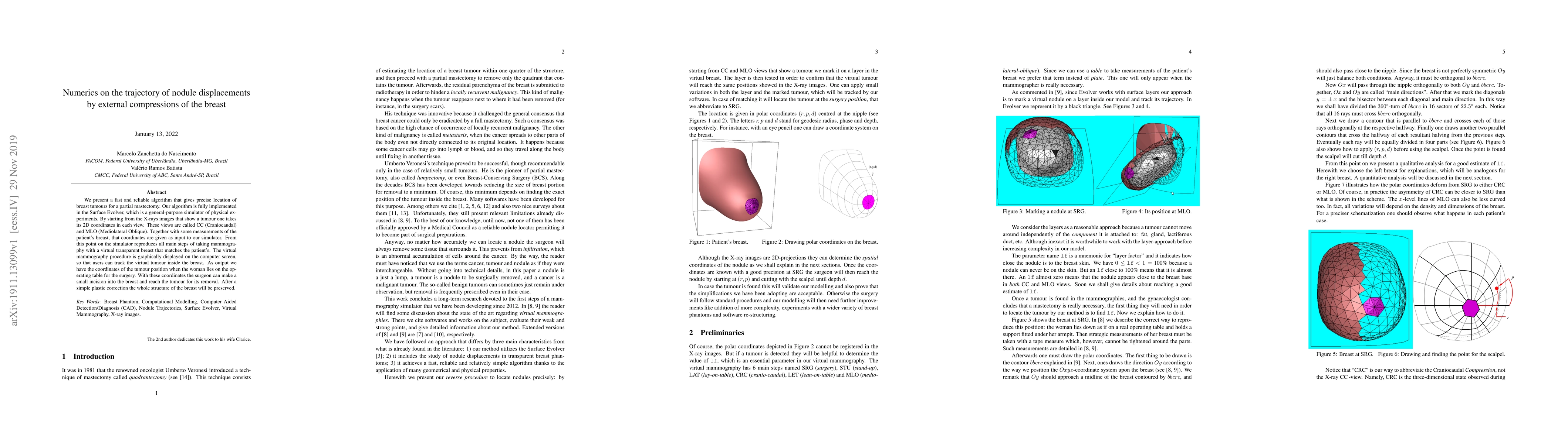 Thumbnail for Numerics on the trajectory of nodule displacements by external
  compressions of the breast
