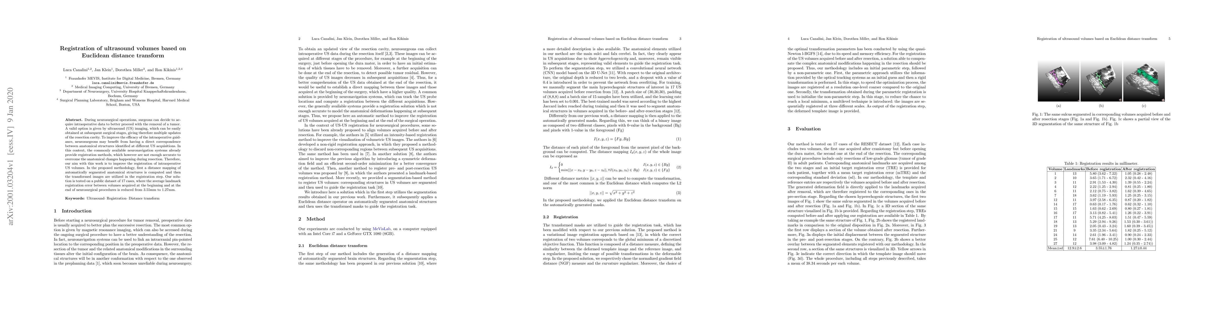 Thumbnail for Registration of ultrasound volumes based on Euclidean distance transform