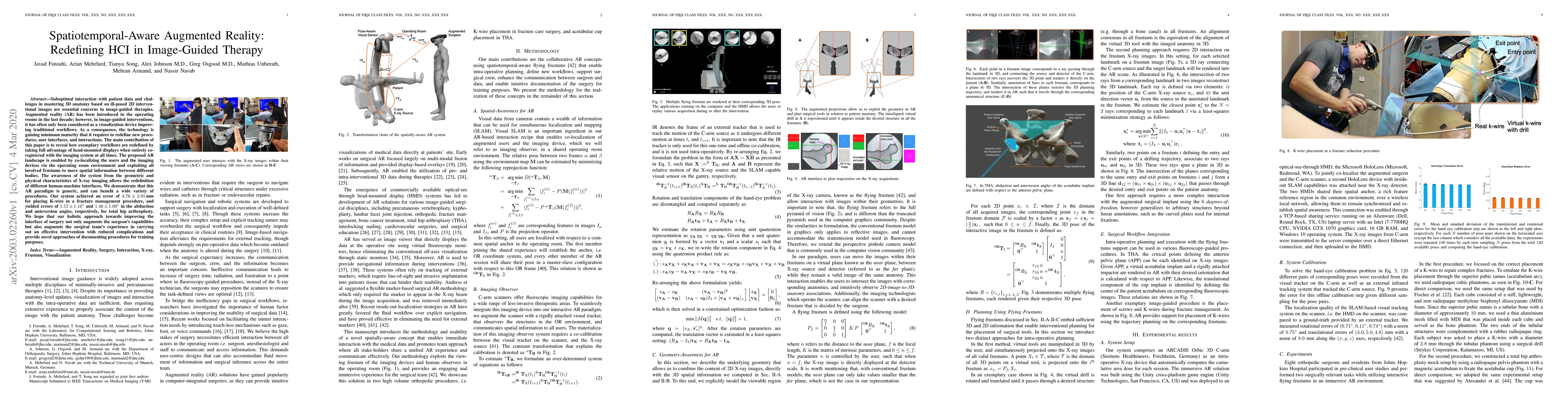 Thumbnail for Spatiotemporal-Aware Augmented Reality: Redefining HCI in Image-Guided
  Therapy