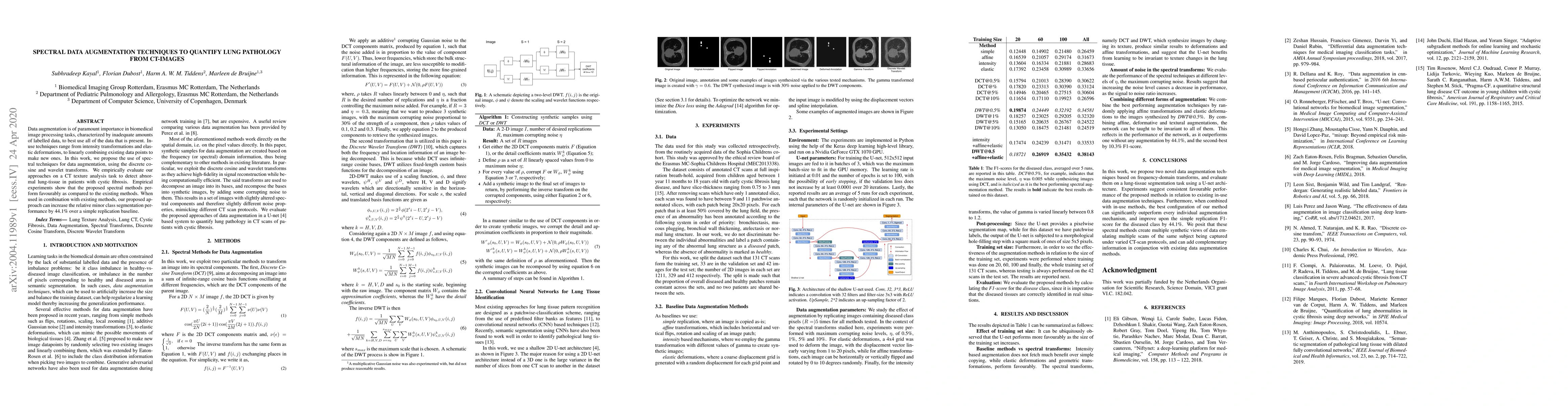Thumbnail for Spectral Data Augmentation Techniques to quantify Lung Pathology from
  CT-images