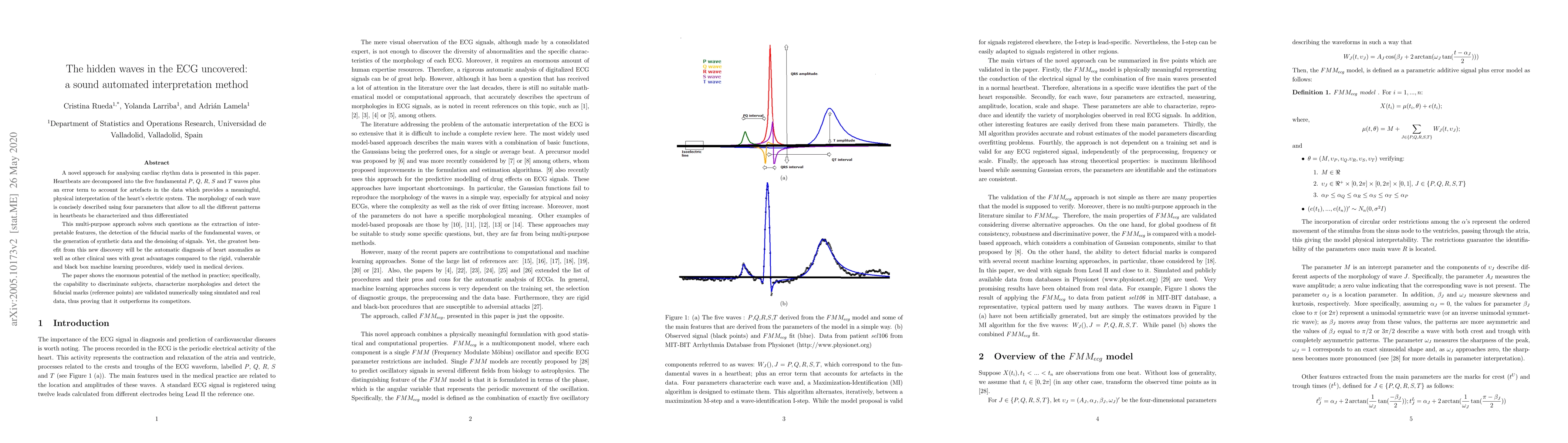 Thumbnail for The hidden waves in the ECG uncovered: a sound automated interpretation
  method