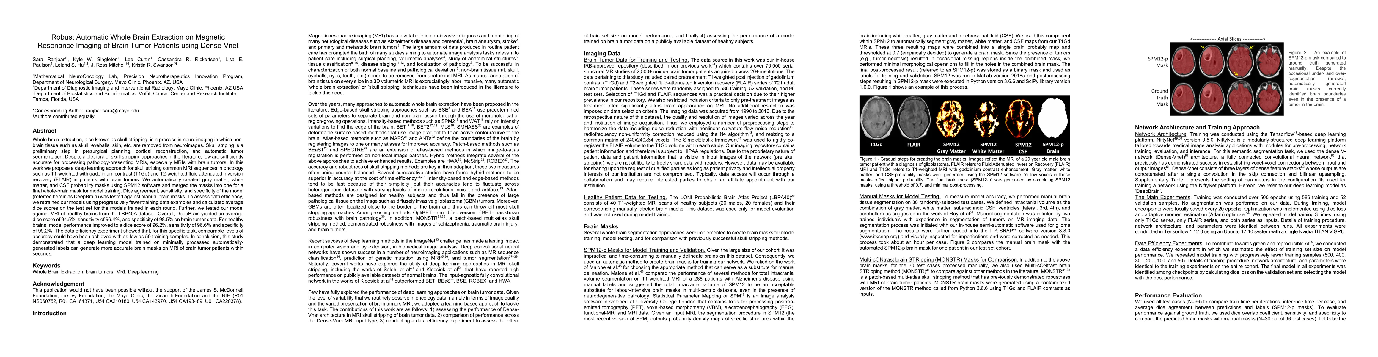 Thumbnail for Robust Automatic Whole Brain Extraction on Magnetic Resonance Imaging of
  Brain Tumor Patients using Dense-Vnet