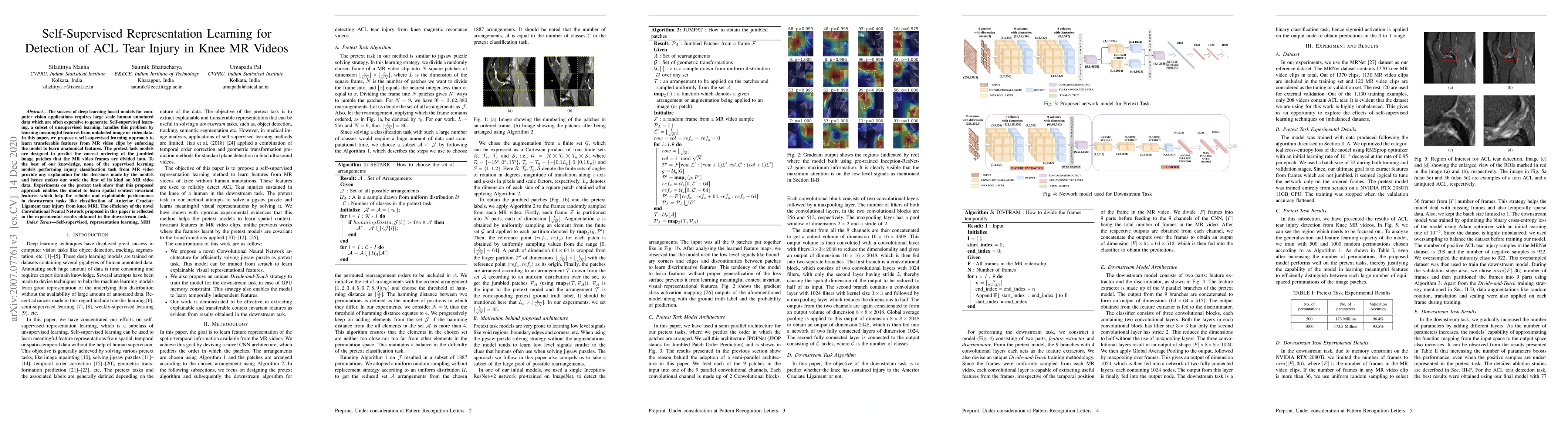 Thumbnail for Self-Supervised Representation Learning for Detection of ACL Tear Injury
  in Knee MR Videos