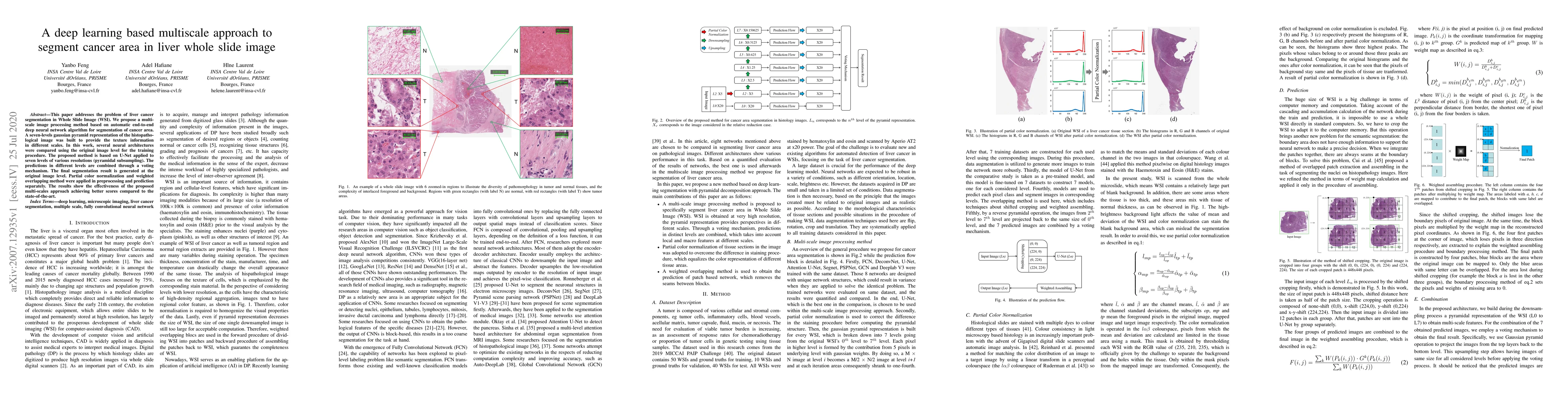 Thumbnail for A deep learning based multiscale approach to segment cancer area in
  liver whole slide image