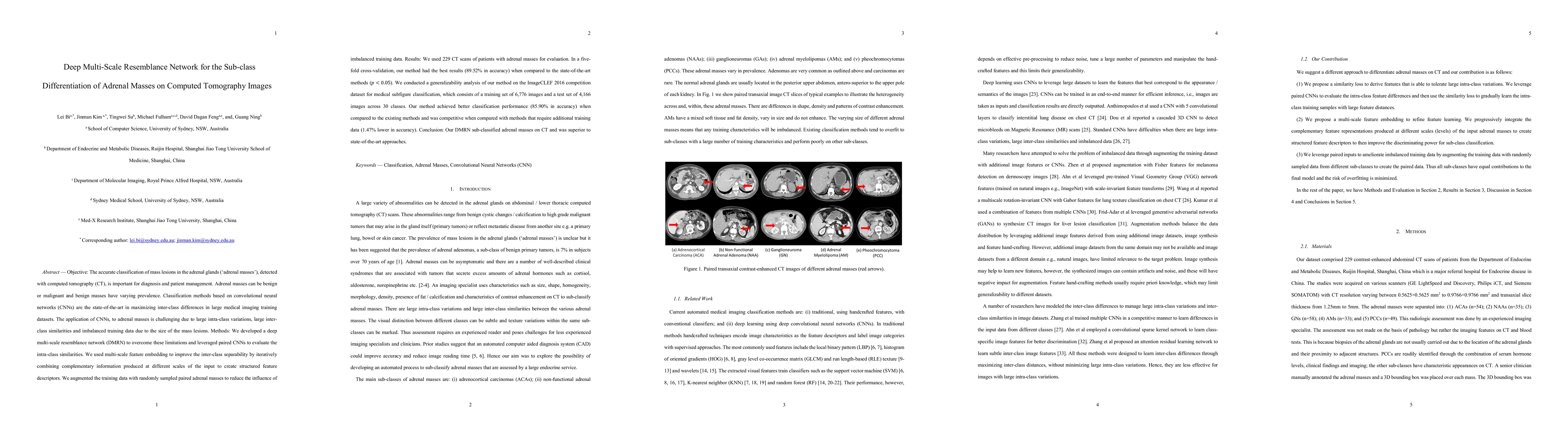 Thumbnail for Deep Multi-Scale Resemblance Network for the Sub-class Differentiation
  of Adrenal Masses on Computed Tomography Images