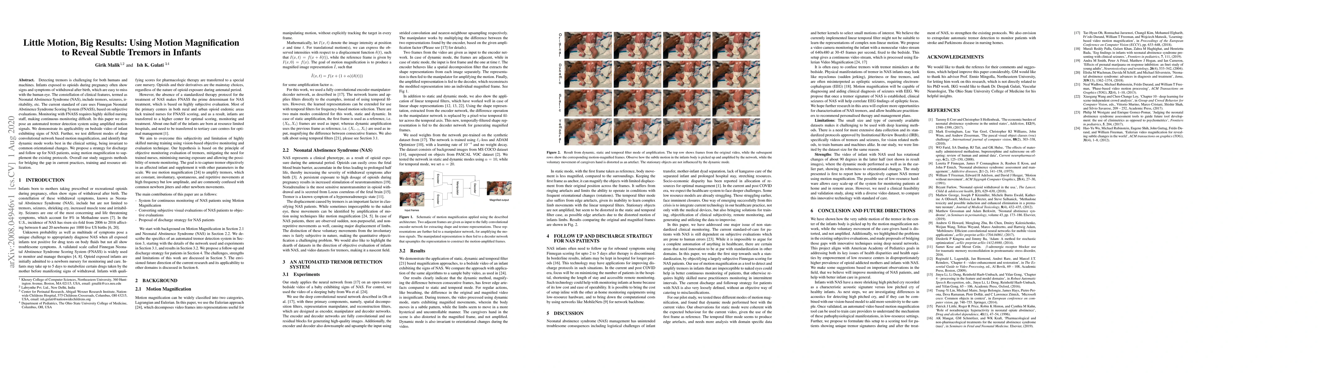 Thumbnail for Little Motion, Big Results: Using Motion Magnification to Reveal Subtle
  Tremors in Infants