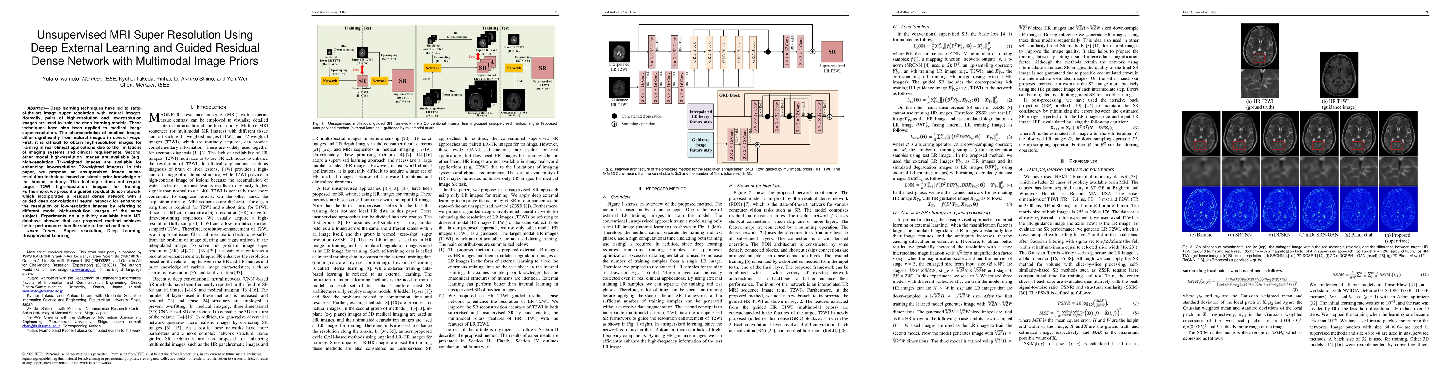 Thumbnail for Unsupervised MRI Super-Resolution Using Deep External Learning and
  Guided Residual Dense Network with Multimodal Image Priors