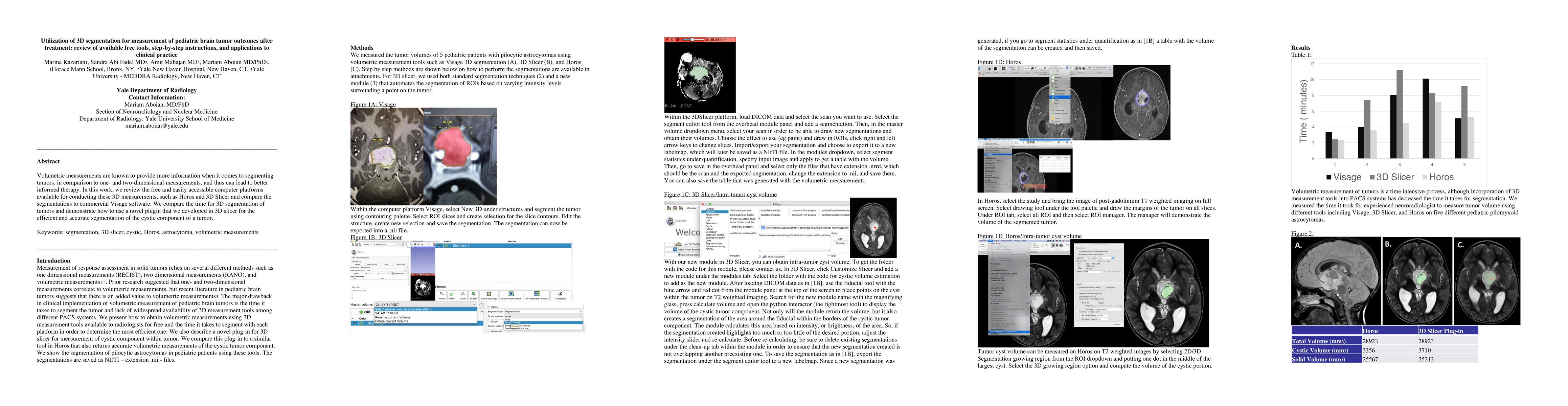 Thumbnail for Utilization of 3D segmentation for measurement of pediatric brain tumor
  outcomes after treatment: review of available free tools, step-by-step
  instructions, and applications to clinical practice