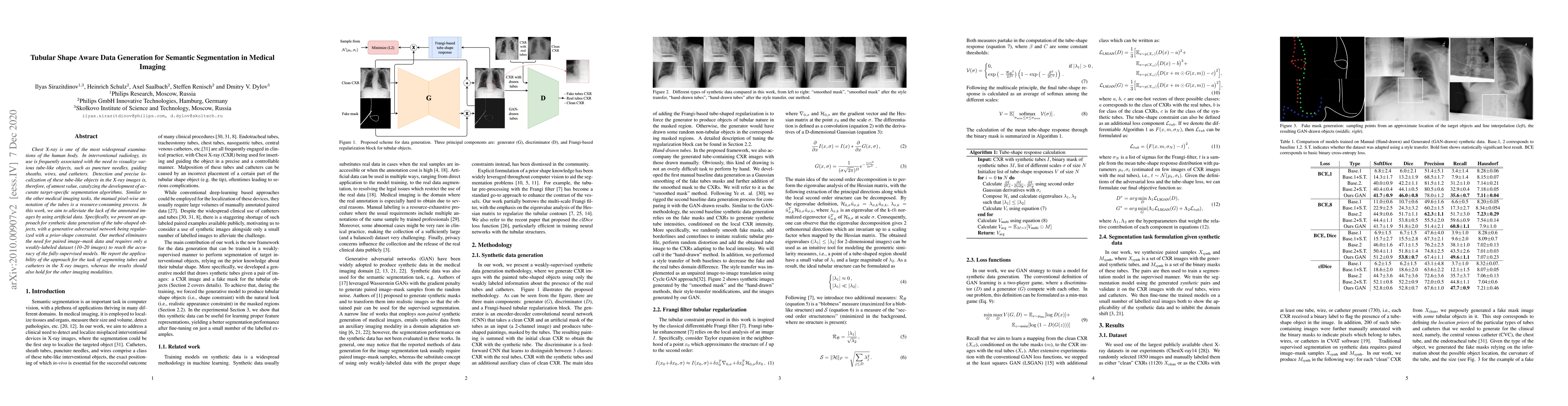 Thumbnail for Tubular Shape Aware Data Generation for Semantic Segmentation in Medical
  Imaging