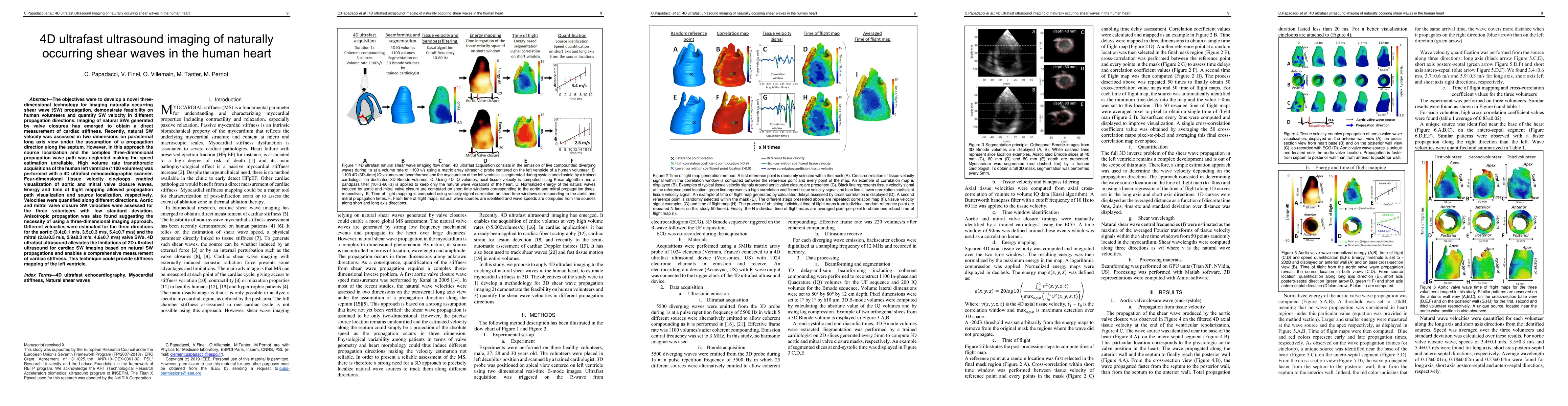 Thumbnail for 4D ultrafast ultrasound imaging of naturally occurring shear waves in
  the human heart