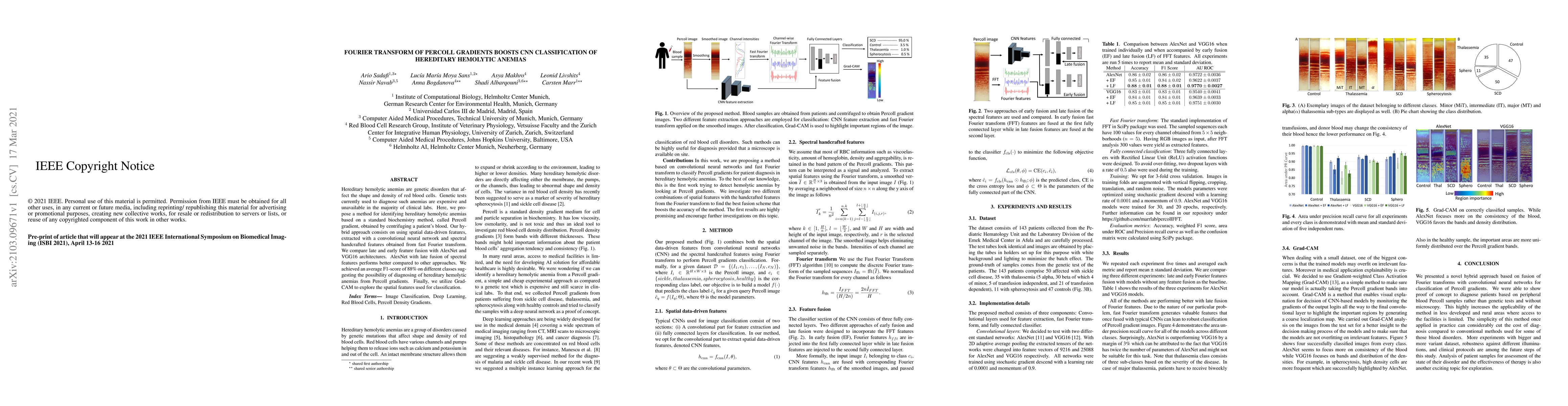 Thumbnail for Fourier Transform of Percoll Gradients Boosts CNN Classification of
  Hereditary Hemolytic Anemias