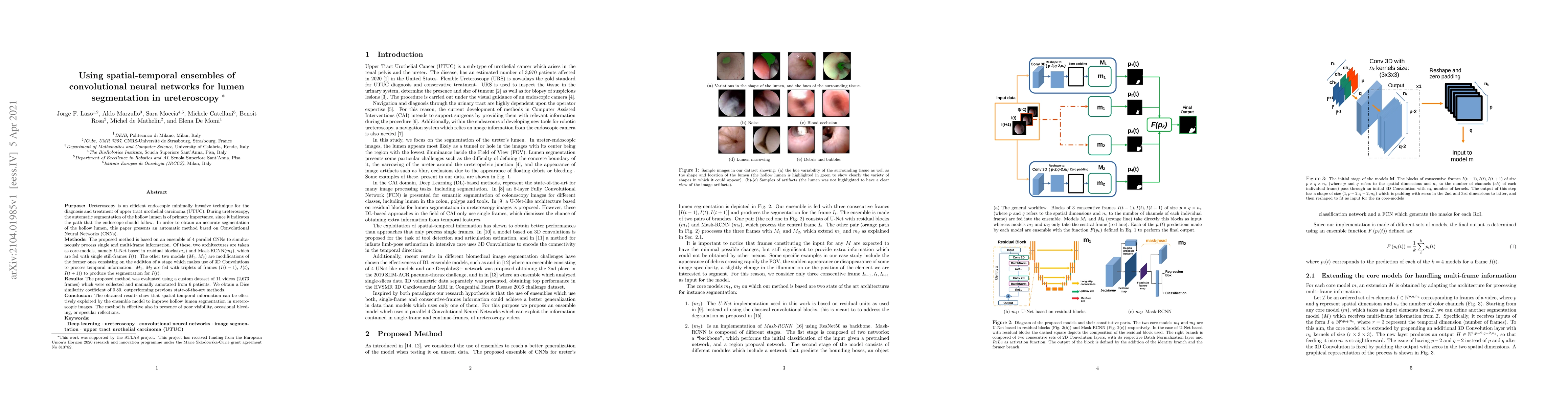 Thumbnail for Using spatial-temporal ensembles of convolutional neural networks for
  lumen segmentation in ureteroscopy