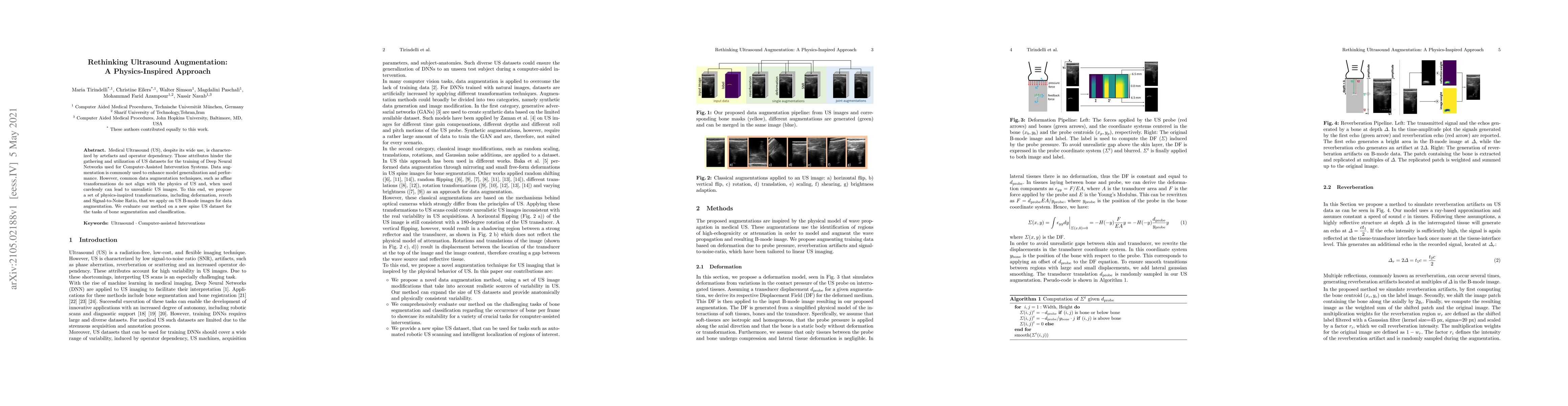 Thumbnail for Rethinking Ultrasound Augmentation: A Physics-Inspired Approach