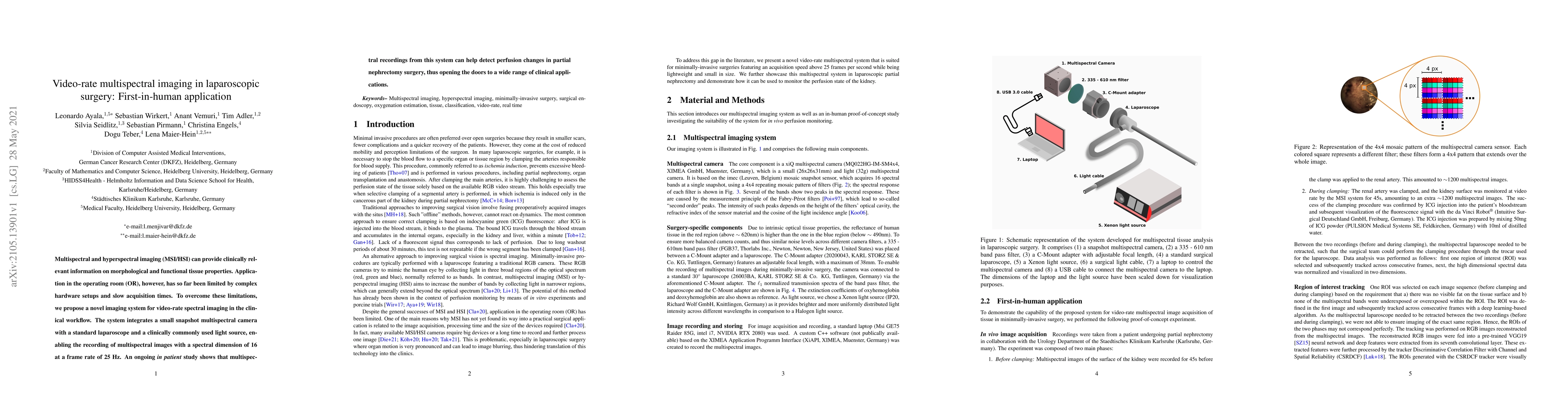 Thumbnail for Video-rate multispectral imaging in laparoscopic surgery: First-in-human
  application